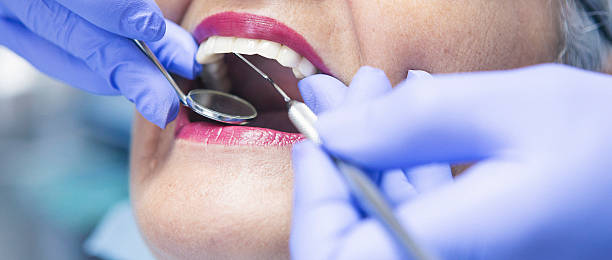 Best Emergency Dentist for Knocked-Out Tooth in Dunlap, TN